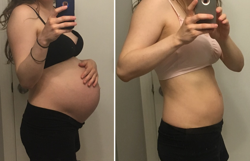 body back after baby 1