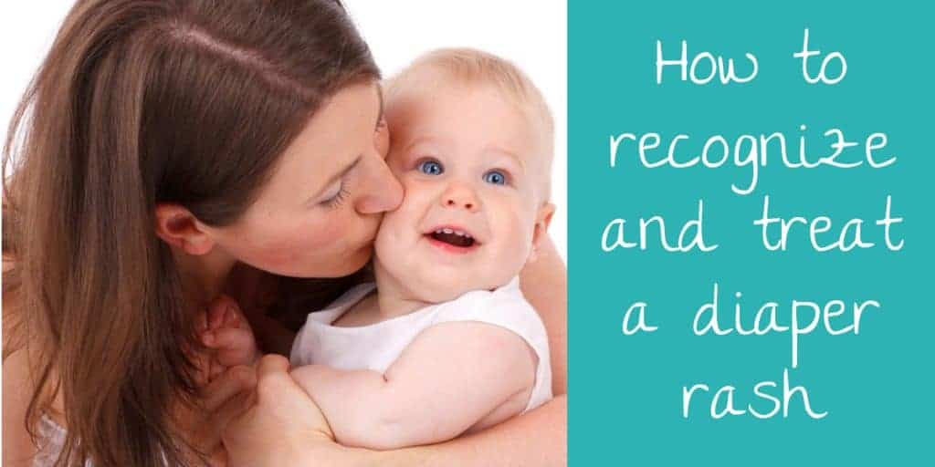 how to recognize and treat a diaper rash
